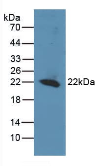 REV1 Antibody (aa301-478)