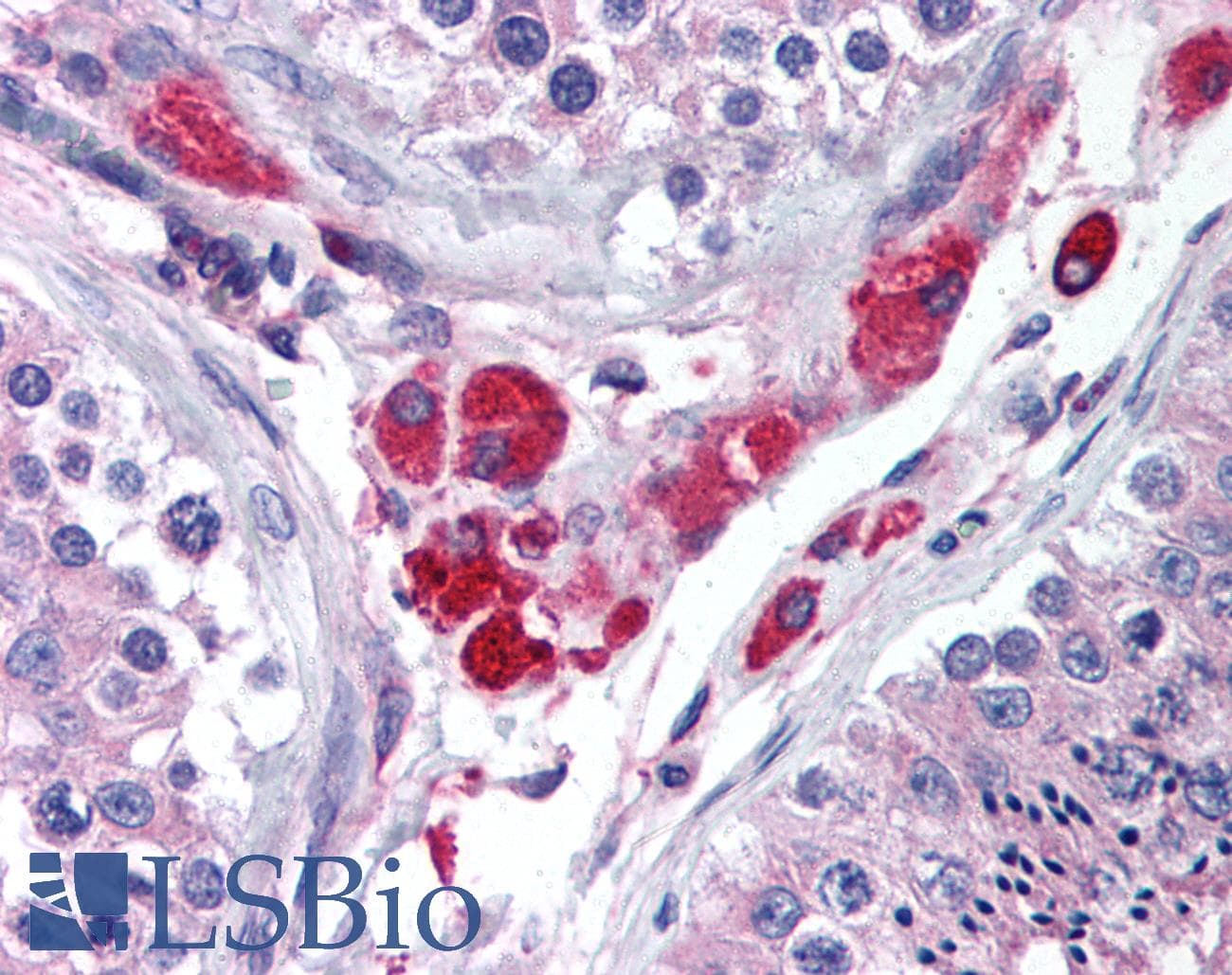 IHC-plus™ HIPK3 / FIST Antibody (aa850-900)
