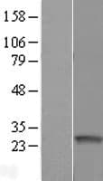 ARFRP1 Protein (Over-Expression Lysate Myc-DDK (Flag))