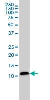 LGALS1 / Galectin 1 Antibody (clone 1E8-1B2)