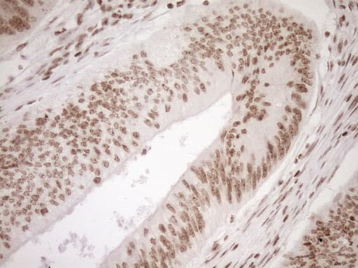 EXOSC1 / CSL4 Antibody (clone OTI1H9)