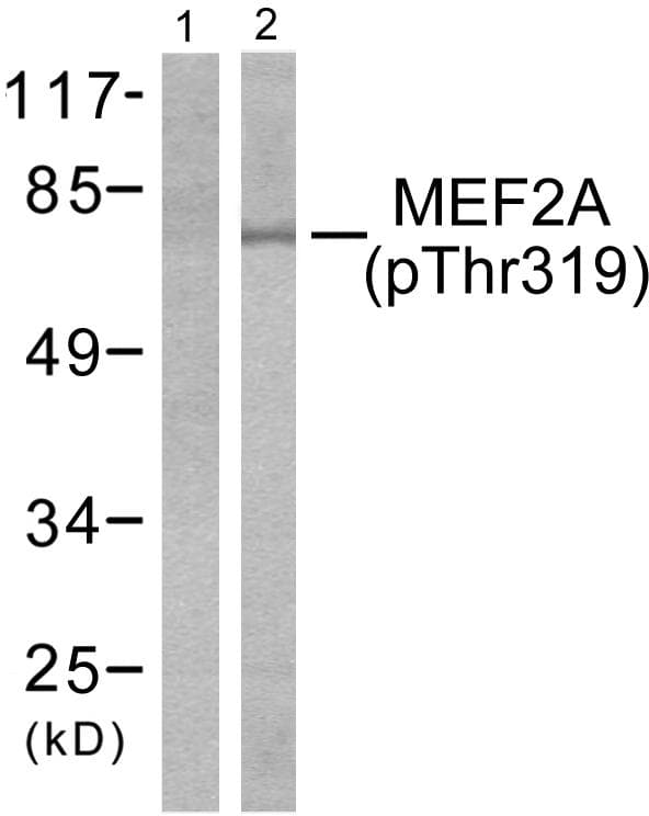 MEF2A / MEF2 Antibody (phospho-Thr319)