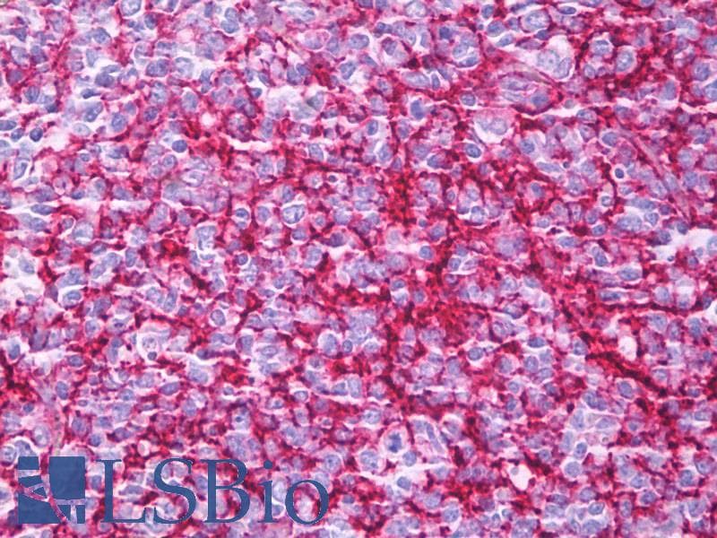 PathPlus™ CR1 / CD35 Antibody (clone E11)