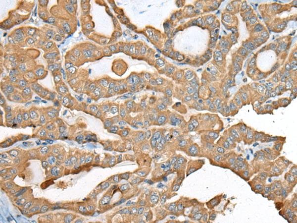 Polyclonal Rabbit anti-Human USP12 Antibody (IHC)
