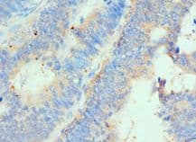HIP1 Antibody (aa410-690)