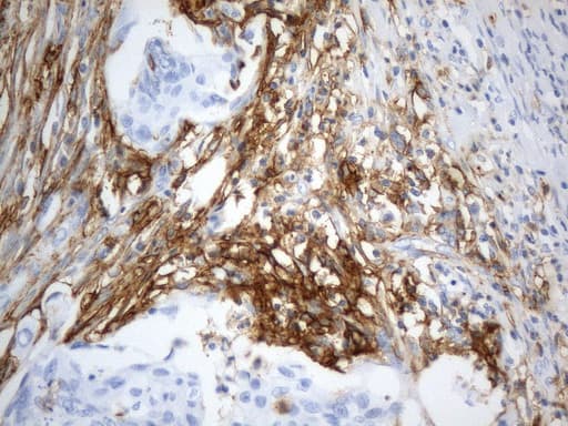 ANPEP / CD13 Antibody (aa668-967, clone UMAB275)