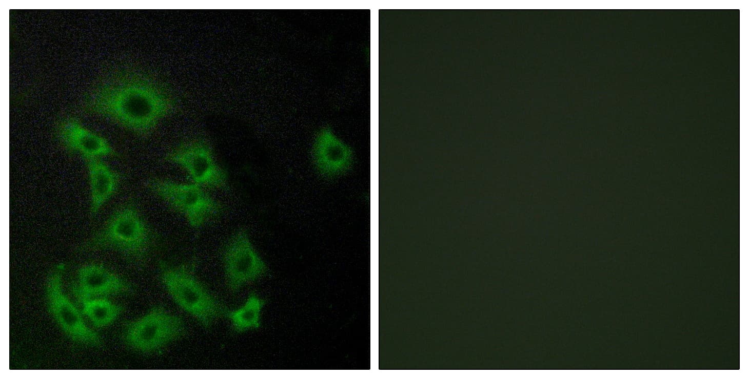 S1PR5 / EDG8 / S1P5 Antibody (aa335-384)