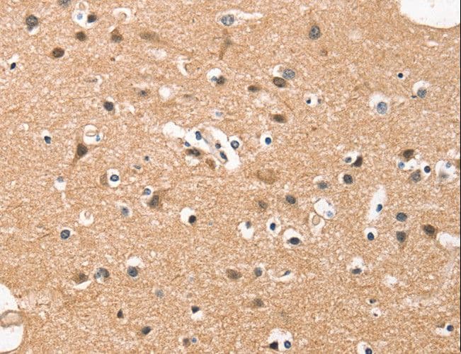 HDAC8 Antibody