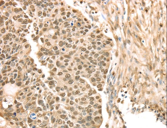 SAMD3 Antibody