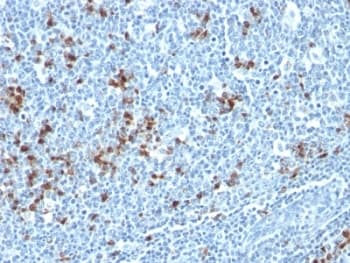 Mouse Anti-Human Kappa Light Chain Secondary Antibody (clone HP6053 + L1C1)