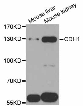 CDH1 / E Cadherin Antibody