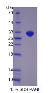 Human LACTB Protein (Recombinant His-S)
