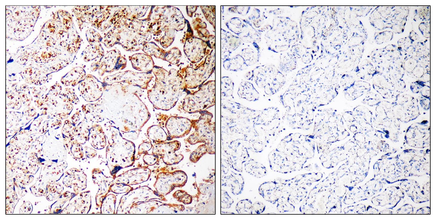 CCDC102B Antibody