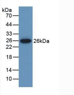 MUSK Antibody (aa517-777)