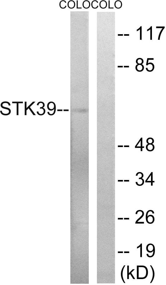 STK39 / SPAK Antibody (p325)