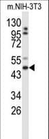 GORAB / SCYL1BP1 Antibody (aa24-52)
