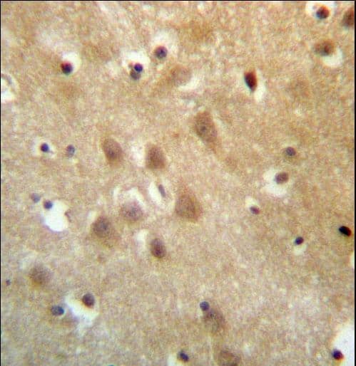 ZNF227 Antibody (aa1-30)
