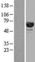 RANGAP1 Protein (Over-Expression Lysate Myc-DDK (Flag))