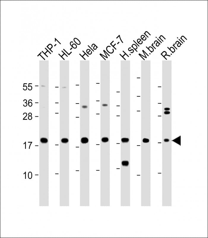 ARPC5 / p16-Arc Antibody (Internal)