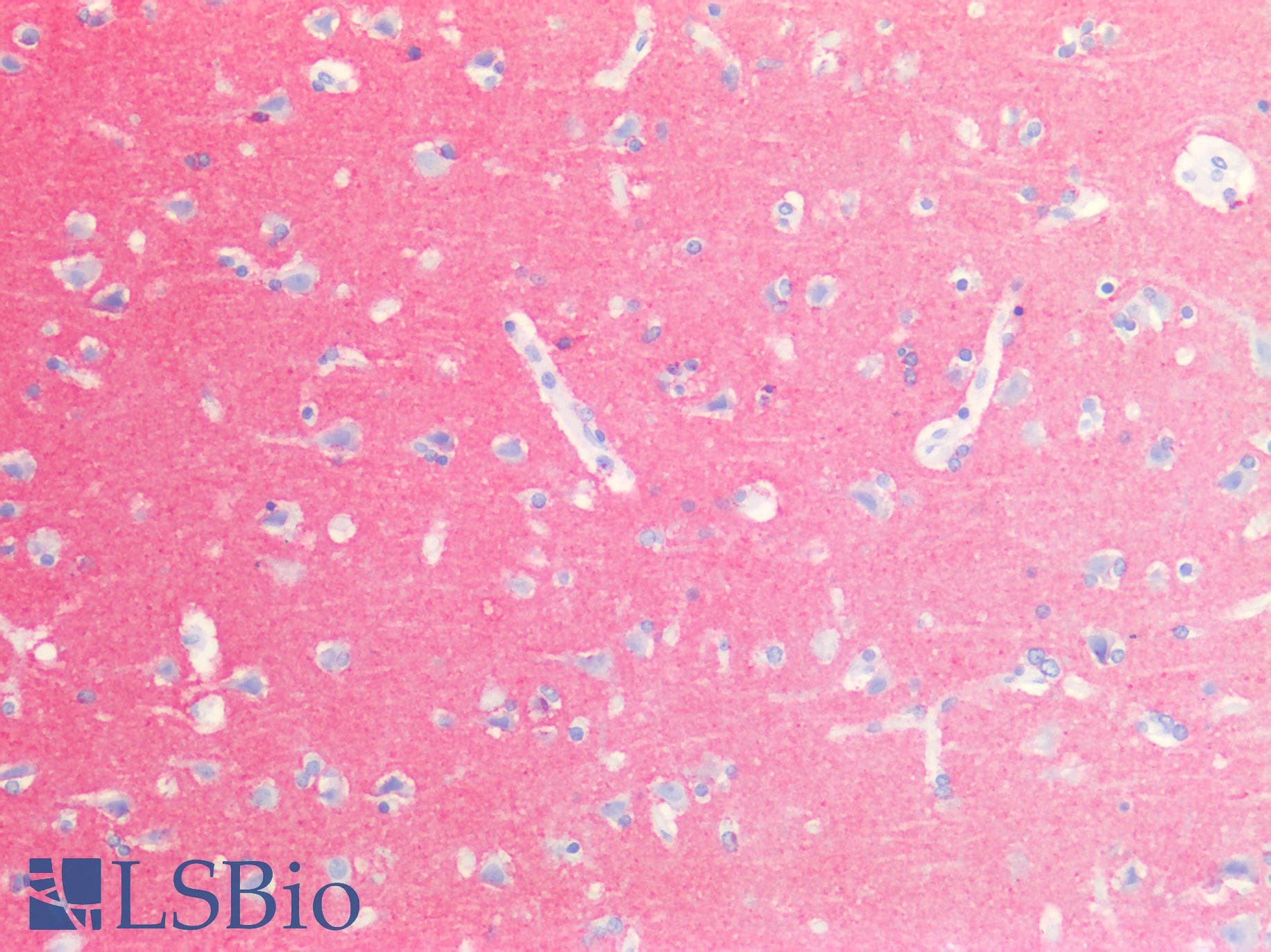 IHC-plus™ NCAM / CD56 Antibody