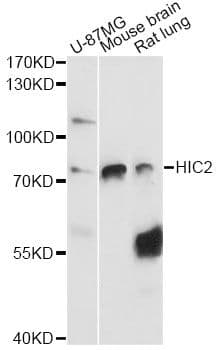 Polyclonal Rabbit anti-Human HIC2 Antibody (WB)