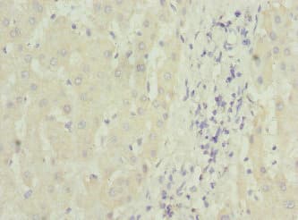 MTCH1 Antibody