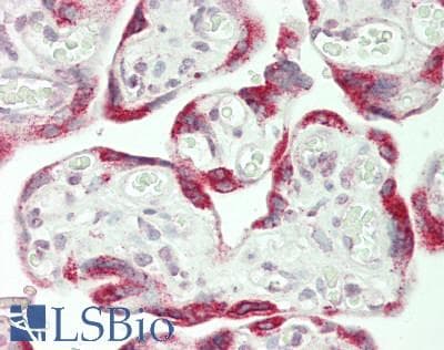 IHC-plus™ GRIP1 Antibody (aa1026-1076)