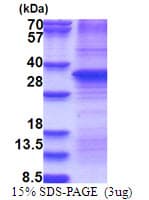 Human HGF / Hepatocyte Growth Factor Protein (Recombinant)