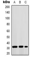 Polyclonal Rabbit anti-Human FFAR1 / GPR40 Antibody (Internal, WB)