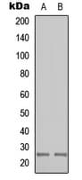 Polyclonal Rabbit anti-Human CABP7 Antibody (N-Terminus, IHC, WB)