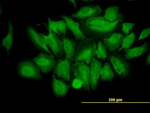IHC-plus™ TRIM25 Antibody (clone 5C3)