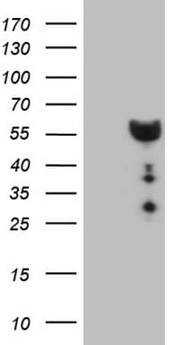 DMRT1 Antibody (aa1-210, clone OTI4B5, Carrier-free)