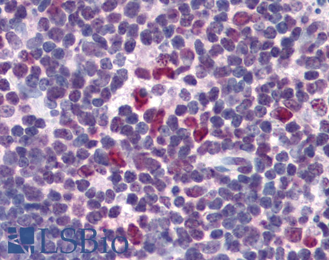 IHC-plus™ Polyclonal Rabbit anti-Human FRMPD3 Antibody (IHC, IF, WB)