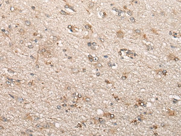 BCHE / Cholinesterase Antibody