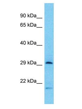 Polyclonal Rabbit anti-Human Tpsb2 / Tryptase Beta 2 (Mouse Antibody (aa31-80, WB)