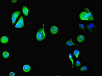 Polyclonal Rabbit anti-Human DYRK4 Antibody (IHC)