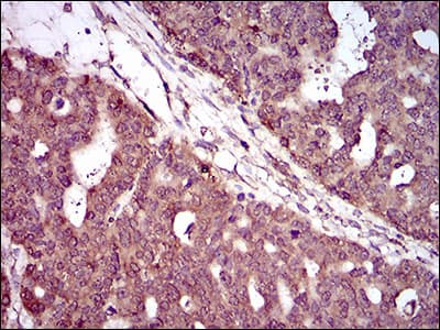 Monoclonal Mouse anti-Human HIWI2 / PIWIL4 Antibody (clone 10G9B11, aa304-434, IHC, WB)