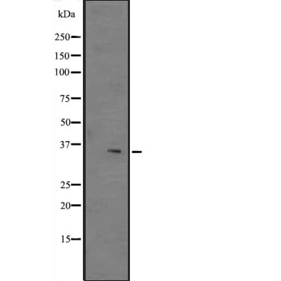 MAX Antibody