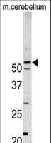 Polyclonal Rabbit anti-Human PFTK1 / CDK14 Antibody (aa1-30, IHC, WB)