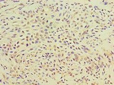 TGM2 / Transglutaminase 2 Antibody (aa438-687)