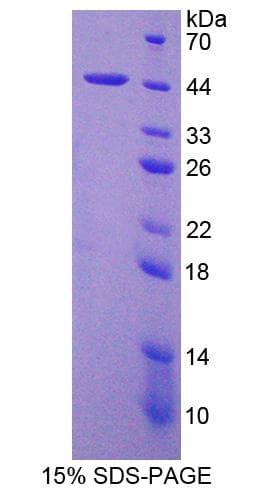 Mouse IL4 Protein (Recombinant His-GST)