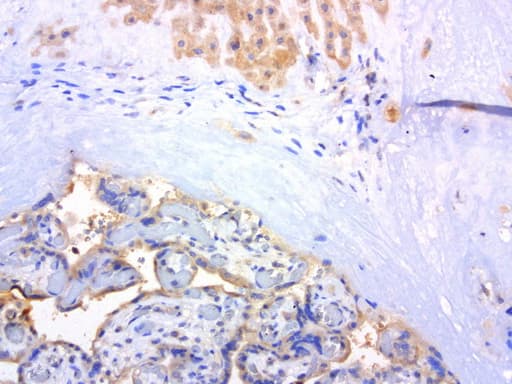 Monoclonal Mouse anti-Human c-Met Antibody (clone UMAB190, Carrier-free, aa570-885, IHC, IF, WB)