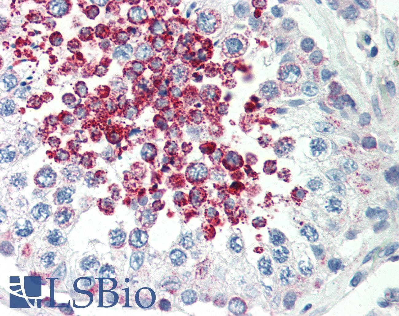 IHC-plus™ CARD10 / CARMA3 Antibody