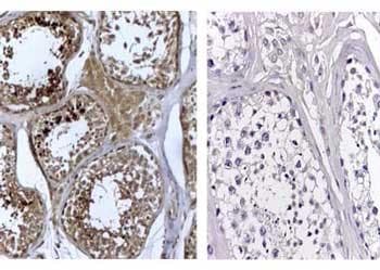 DNMT3L Antibody