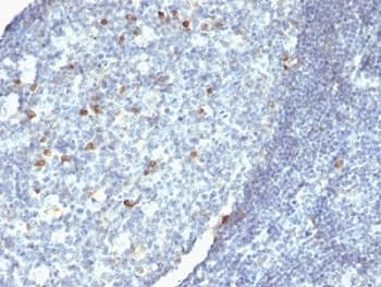 Mouse Anti-Human IgM Secondary Antibody (clone IM260 + IM373 + ICO-30)