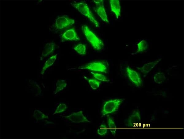 Monoclonal Mouse anti-Human PSMB10 Antibody (clone 3F8, IF, WB)
