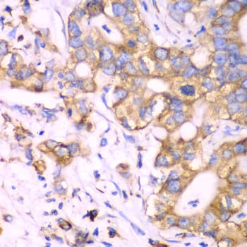 RPS3A / Ribosomal Protein S3A Antibody