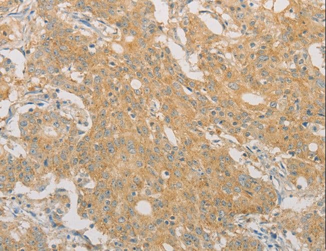 Polyclonal Rabbit anti-Human PRPSAP1 Antibody (IHC)