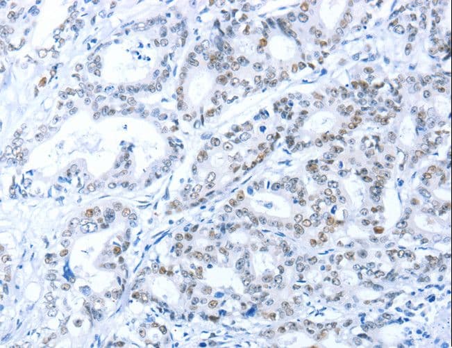 Polyclonal Rabbit anti-Human ARID1A / BAF250 Antibody (aa95-108, IHC)