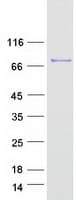 Human EFHC1 Protein (Recombinant Myc-DDK (Flag))